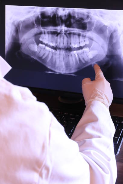 Best Emergency Tooth Extraction in Davenport, WA